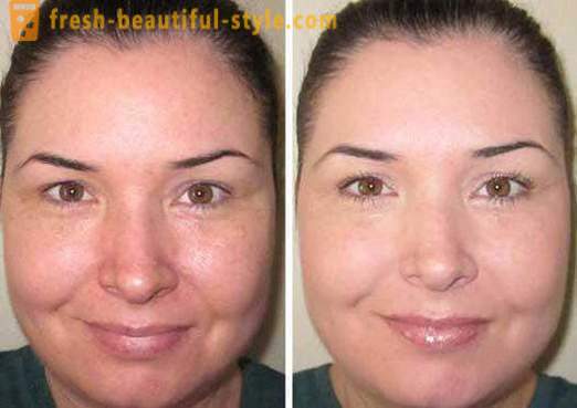 Der Toner für das Gesicht - was ist es und wie es zu benutzen? Hautpflegeprodukte Gesicht