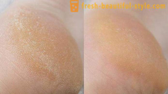 Kosmetische Fußpflege „Nanopyatki“: Bewertungen, Gebrauchsanweisungen und Zusammensetzung