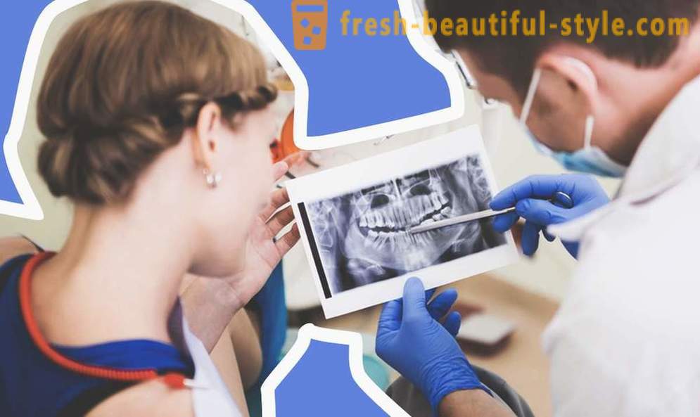 4 Fragen zu Zahnimplantaten