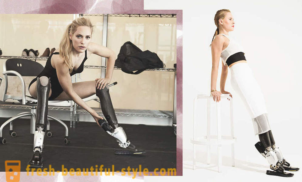 Unendliche Schönheit: 6 weibliche Modelle mit Prothesen