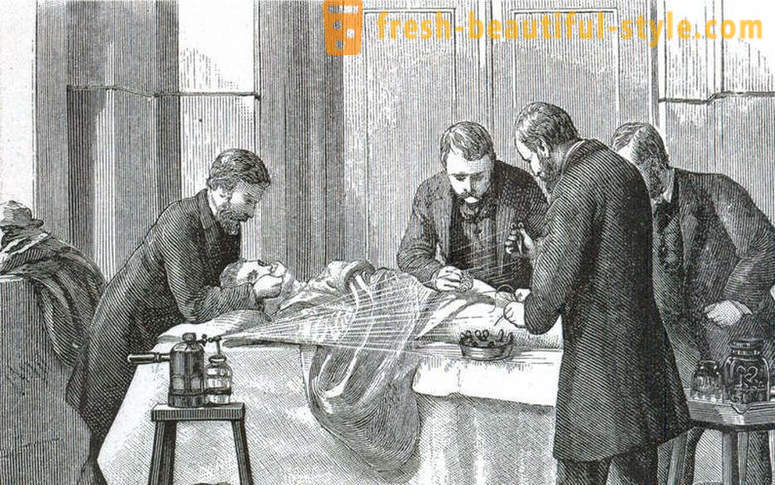 Schockierende Fakten über die Victorian Chirurgie