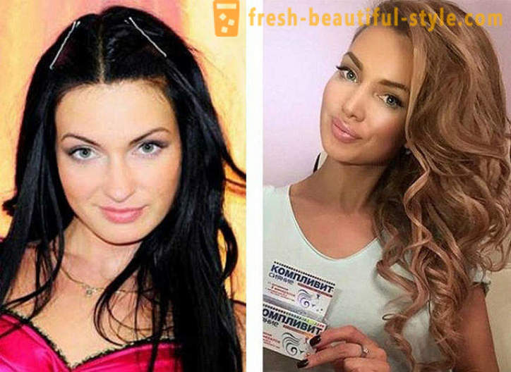 10 russische Schönheiten vor und nach der plastischen