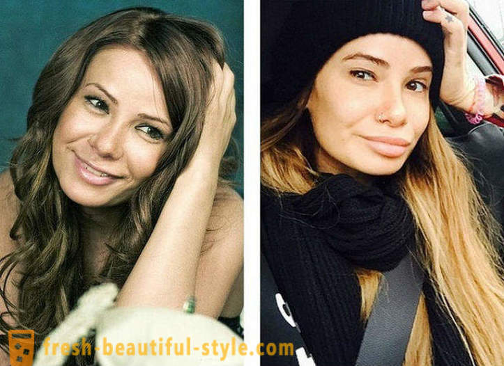 10 russische Schönheiten vor und nach der plastischen