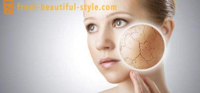 Schuppige Haut auf dem Gesicht und Händen: mögliche Ursachen und Merkmale der Pflege
