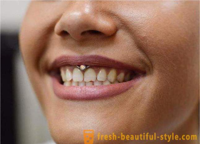 Piercing „Smiley“ - ein Einstich unter der Lippe frenulum: Nachwirkungen, Bewertungen