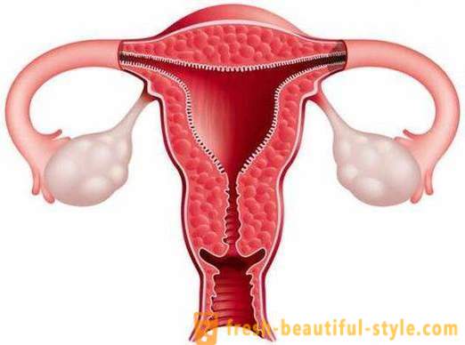 Wie das Endometrium zu erhöhen