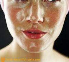 Fettige Haut Gesicht: Was tun mit dem Problem zu befassen, zu tun?