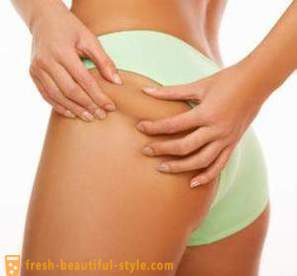 Cellulite zu Hause kämpfen: Kosmetik, Körperpackungen, Massagen